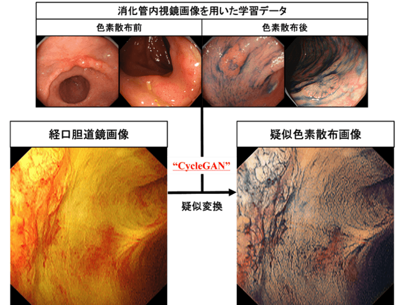図1:白色光画像(左)から疑似色素散布画像(右)へのAIによる変換技術