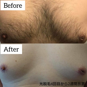 JQNL4DDqNkN3JZRUvWVP.jpg?w=940&h=940