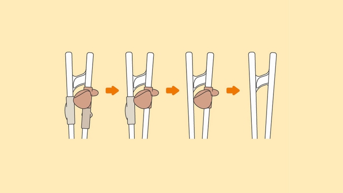 パーツを外してステップアップ