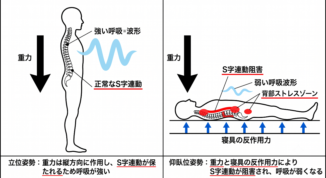 睡眠時無呼吸症候群（SAS）の本質──気道だけでは説明できない"重力・寝具・姿勢"の構造的リスク"を解析【CPAP・SASシリーズ／第2回】