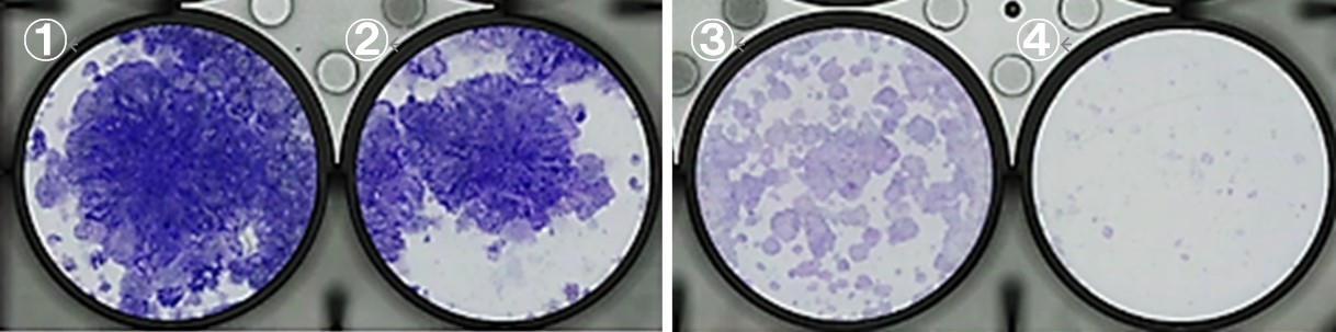 図2 肺がん細胞株を用いた薬剤感受性試験 ①無治療 ②パトリツマブ デルクステカン単剤治療 ③オシメルチニブ単剤治療 ④併用治療