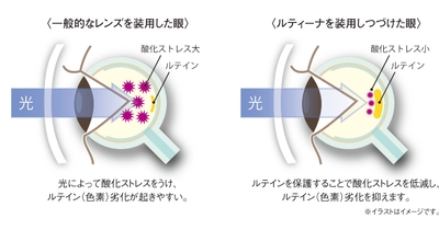 ルティーナ装用イメージ図