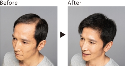 LJ79pRW0BD3Q6XaZGATG.jpg?w=940&h=940