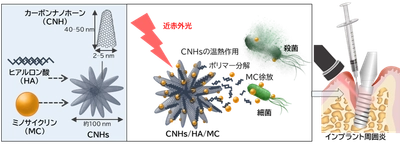 【名城大学・北海道大学】インプラント周囲炎に対する光応答性ナノ複合体を開発