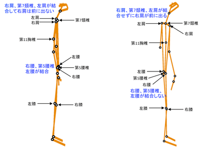 　　　　　図1（Ⅰ型タイプの『Csc』画像　　　　　　　　　　　図2（Ⅱ型タイプの『Csc』画像）
