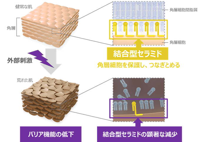「セラミドと肌のバリア機能の関係」に関する研究成果の概要(イメージ)