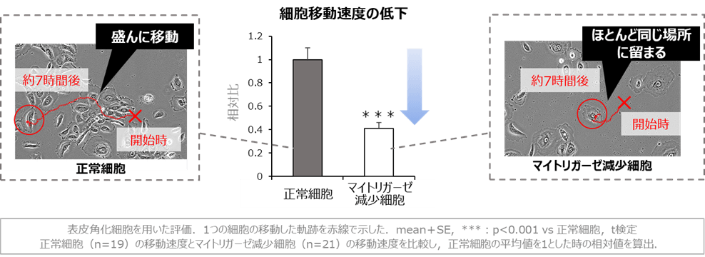 図4 マイトリガーゼの減少による細胞移動速度の低下