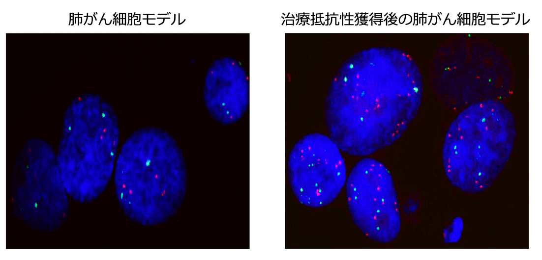 KRAS阻害薬抵抗性獲得前後におけるMET遺伝子のFISH画像の比較