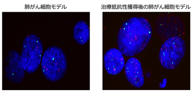 KRAS阻害薬抵抗性獲得前後におけるMET遺伝子のFISH画像の比較