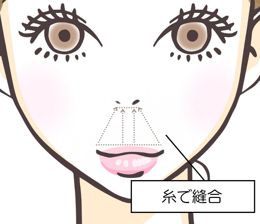 施術イメージ(2)