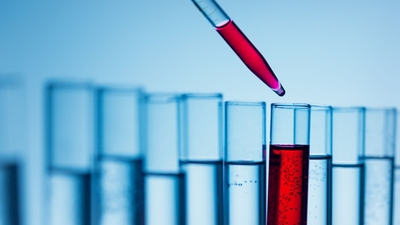 NqxOZWkxyWBwjz28qjjB.jpg?w=940&h=940