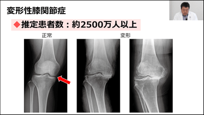 NtVAzkQaqsH7N57CSYGV.png?w=940&h=940