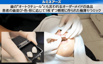 当院のルミネアーズを選ぶべき3つの理由