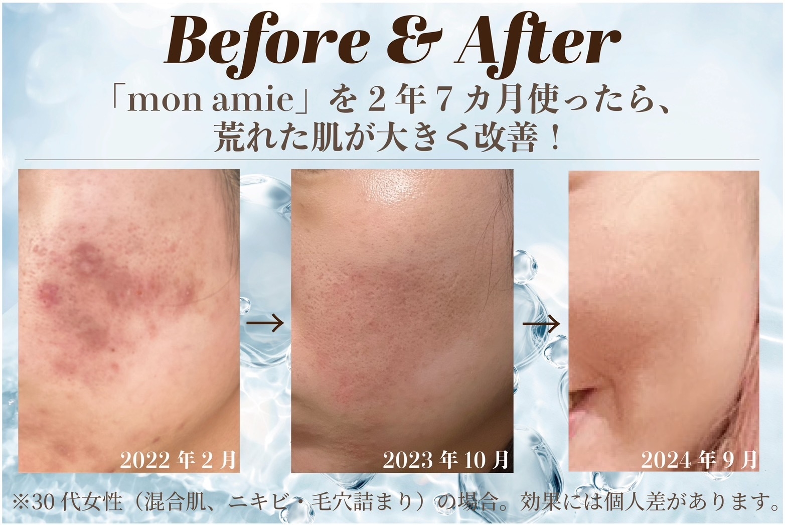 体験者の肌に起きた奇跡