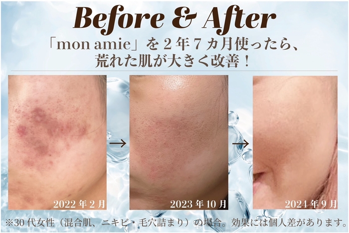 体験者の肌に起きた奇跡