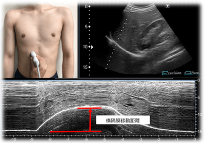 超音波画像診断装置を使用し、横隔膜移動距離を測定する様子