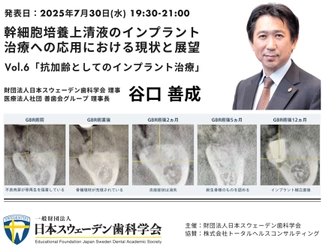 インプラント治療は「アンチエイジング」の領域へ｜幹細胞培養上清液の臨床応用から見る歯科治療の新たな可能性