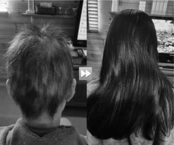 ４０代女性 ケア前→ケア後　※写真：福岡県 WOOD HEAL・垣田惠子様 提供