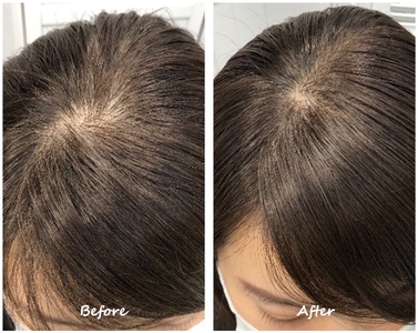 Q9hlBbAkklDm6VhzyZ5F.jpg?w=940&h=940