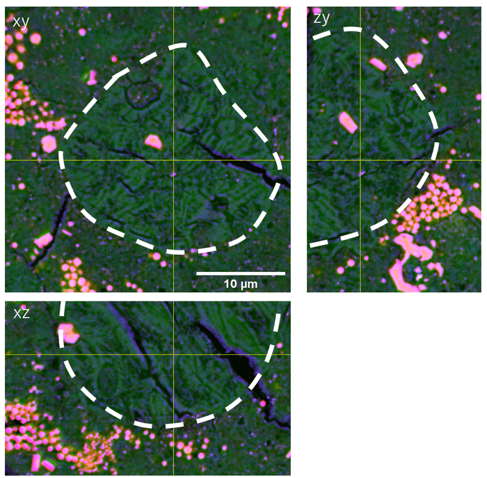 図5 コンドリュールが水質変成を受けたもの(枠線内) サンプル:C0076-CT002