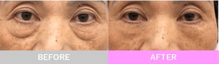 2021年5月発売以来、爆発的に売れている“瞬間小じわ隠し化粧下地