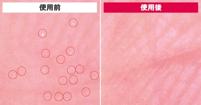 RRAJvhTGbTiOs9jof043.jpg?w=940&h=940