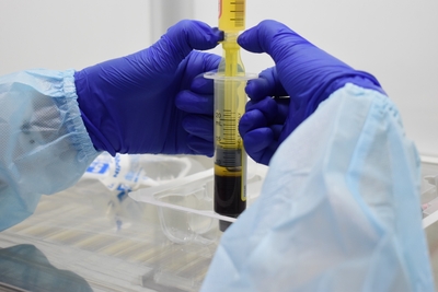 患者自身の血液や脂肪由来細胞を活用した再生医療