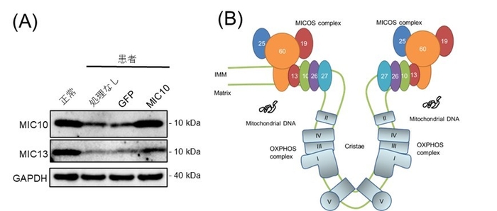 図3 MIC10タンパク質の消失およびMICOS複合体:(A)患者由来線維芽細胞では、MIC10タンパク質およびMIC13タンパク質が減少していました。それは、MICOS10 遺伝子を細胞内に戻すことで回復されました。(B)MICOS複合体は、ミトコンドリア内膜(IMM)に存在し、MIC10,13,19,25,26,27,60から構成されています。これらは、クリステ構造を形作るのに重要な役割を担っています。