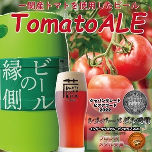 SueZzx8aC9i0dzRGCSVB.jpg?w=940&h=940