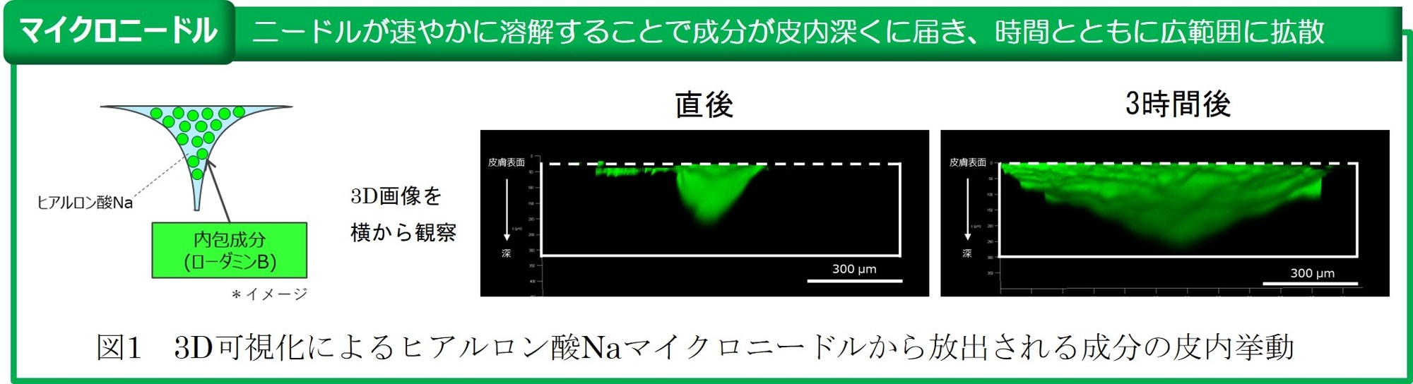 ヒアルロン酸Naマイクロニードルによる皮内深くに成分を届ける性能を3D可視化