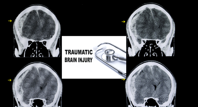 TiRXGb9hm7Oro7FN9JgH.png?w=940&h=940