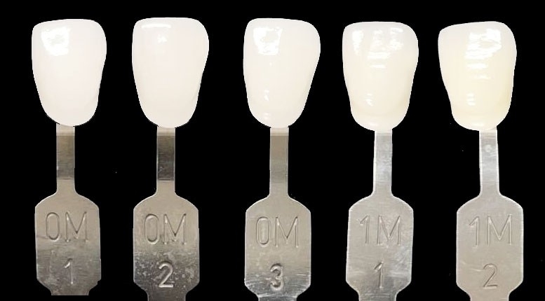 ハリウッドスマイルの白さ「ルミネアーズ」