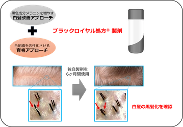 富士産業、育毛アプローチを組みあわせた独自製剤による 白髪改善効果に関する研究結果を公開