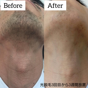 UlQa4vVWAM7RfhbiGzst.jpg?w=940&h=940