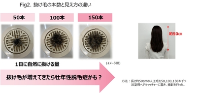 UlX5P89gJb3pUSyTKa6t.jpg?w=940&h=940