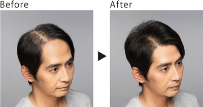 UlpDNDX8oEqKi0gUFCqE.jpg?w=940&h=940