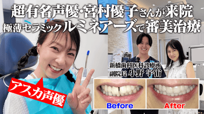人気声優・宮村優子さんが新橋歯科医科診療所で「ルミネアーズ」を体験