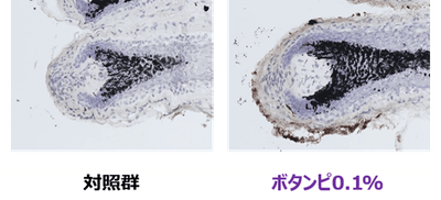 W5BKpqCpL5AEA1SUXoUZ.png?w=940&h=940