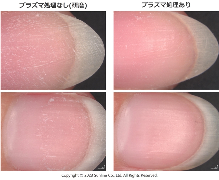 図3.ネイルオフ時の爪甲外観の比較