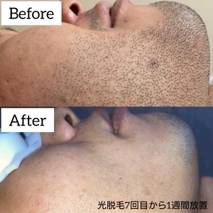 WK5yUIYAN5Uv6ilUMyxm.jpg?w=940&h=940