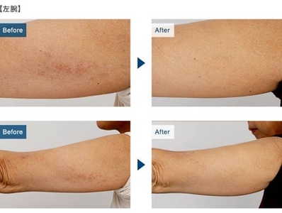 Wdxp9uUln5zulH0SNQpL.jpg?w=940&h=940