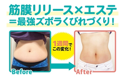 WhKH9ZgauSpahfCEQQry.jpg?w=940&h=940