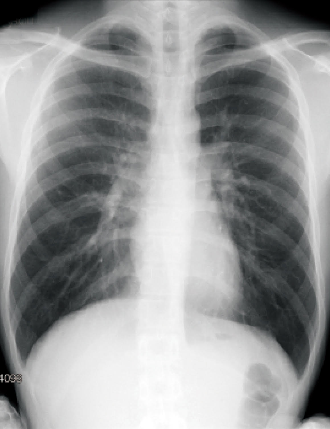 賛育会、PHR「カルテコ」で検査画像の閲覧が開始 レントゲン・マンモグラフィなど健診情報を過去にさかのぼって確認