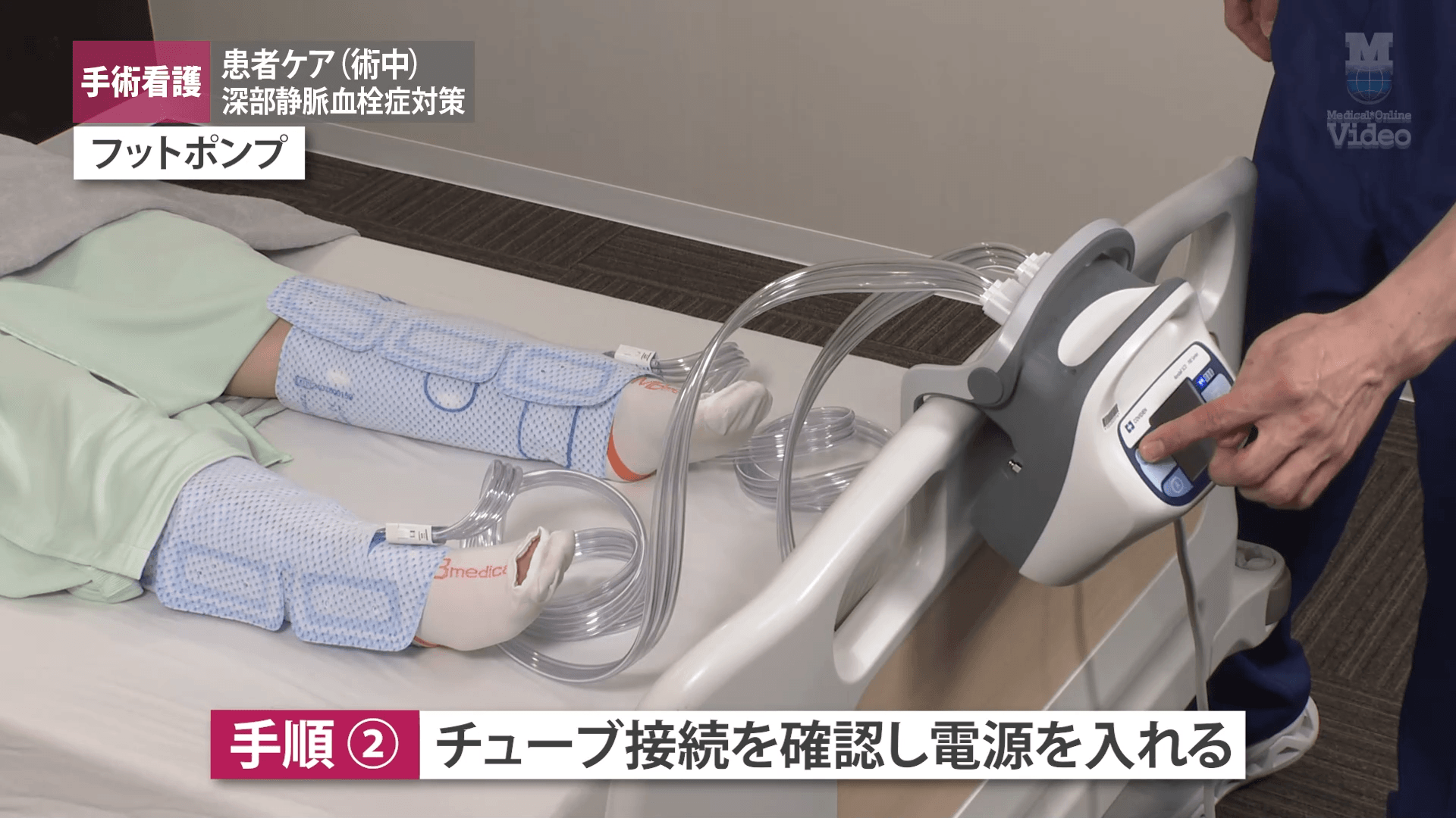 深部静脈血栓症対策