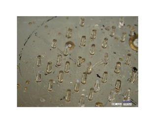 GSアライアンスが、人体に優しい天然素材を主成分として、 体内で溶解する生分解性マイクロニードルを開発