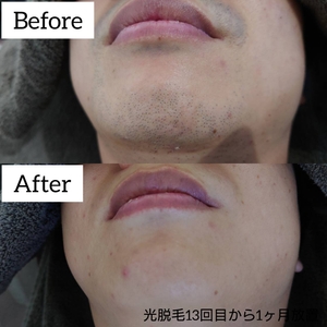 YmFq8xKqEPLEZ98jdi69.jpg?w=940&h=940