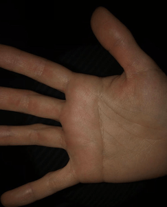 Yz042Qu8fjWdgvelL8DB.png?w=940&h=940