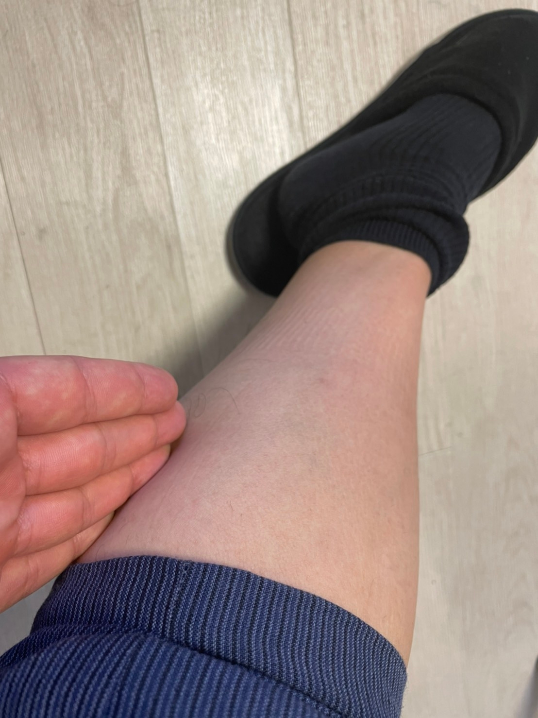 メンズ脱毛＝女性ウケ抜群！学生でも出来る夏の無駄毛処理！