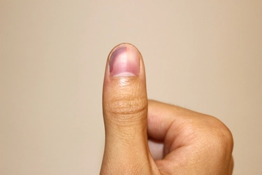 注意!爪が真っ黒になったらまずやるべきセルフチェック!軽度から重傷まで3つの病状を見分ける方法