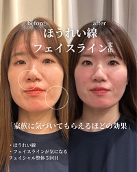 小顔矯正×内臓整体「フェアリー式トータル矯正」大阪で新サービス開始